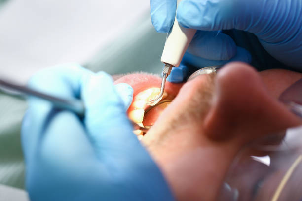 Best Knocked-Out Tooth Emergency  in Glenolden, PA