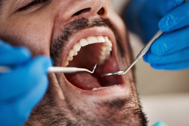 Best Dentist for Tooth Abscess  in Glenolden, PA